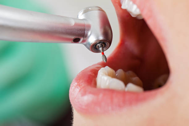 Best Urgent Care for Lost Fillings or Crowns in Hazel Crest, IL